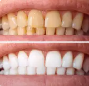 Before and after case 5