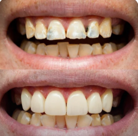 Before and after case 6